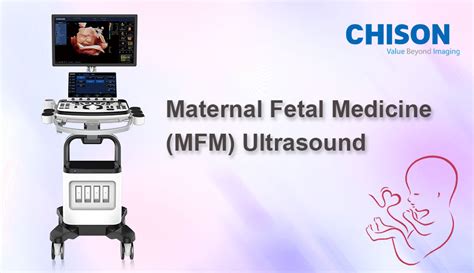 mfm lifestyle|Maternal Fetal Medicine FAQs .